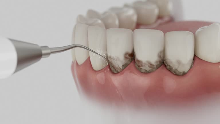 Trusted Root Canal Treatment service in Canonsburg, PA - Dentist Open Now